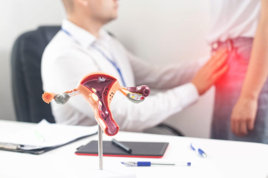 Endometriosis Symptoms and Diagnosis